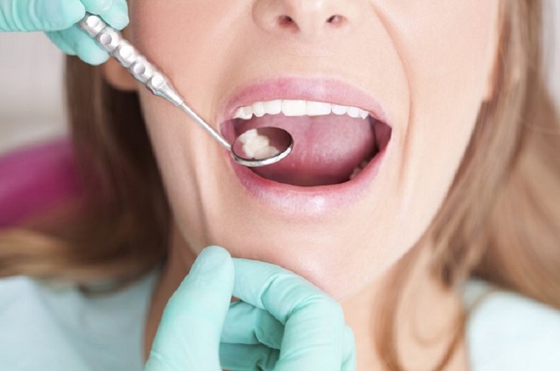 Nhổ răng sâu cần có chỉ định của bác sĩ