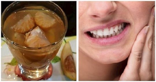 Phương pháp dùng cau ngâm rượu trị sâu răng được rất nhiều chuyên gia đánh giá cao