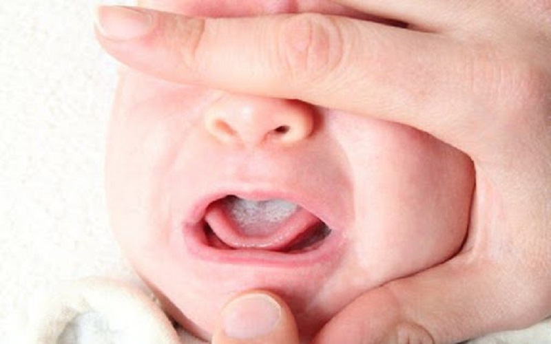 Nguyên nhân khiến bé 8 tháng chậm mọc răng