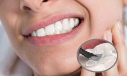 Các nguyên nhân chính gây ra hiện tượng bị ê răng sau khi trám