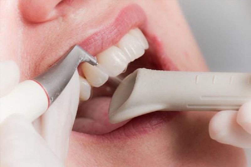 Bạn cần tới gặp nha sĩ nếu thấy triệu chứng ê răng kéo dài