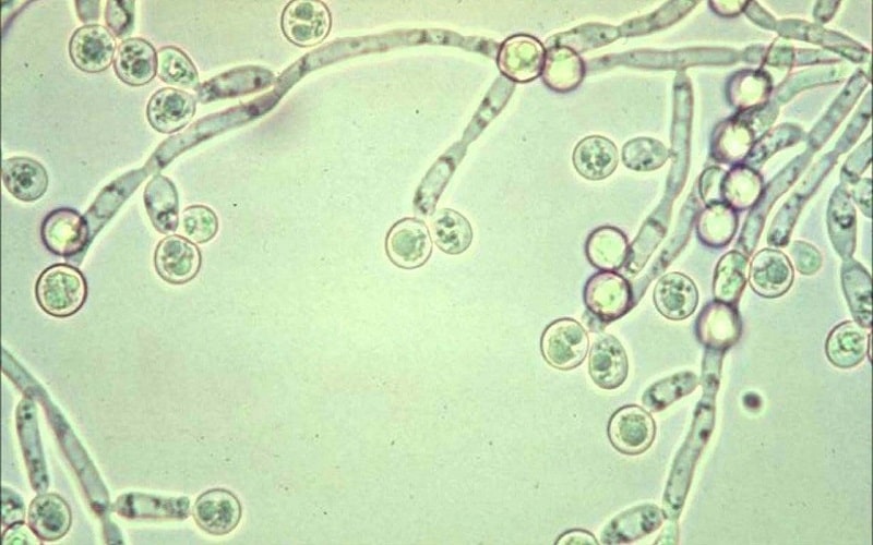 Hình ảng ấm Candida albicans dưới kính hiển vi