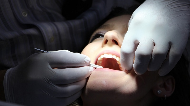 Bác sĩ có thể phát hiện ra bệnh tưa lưỡi ngay sau khi quan sát