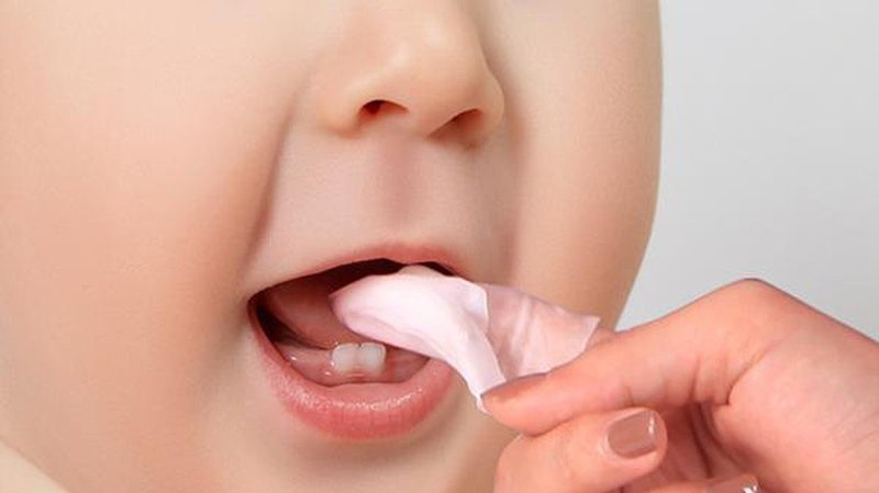 Vệ sinh răng miệng không đúng cách là nguyên nhân chính gây nấm miệng