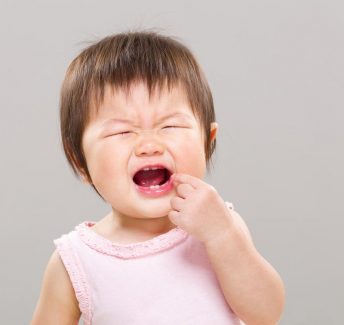 răng sữa nhổ còn sót chân