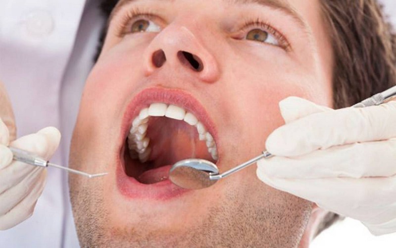Người bị sún răng sẽ được thăm khám tình hình bệnh cụ thể trước khi quyết định