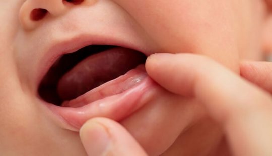 Trẻ 9 tháng chưa mọc răng có sao không