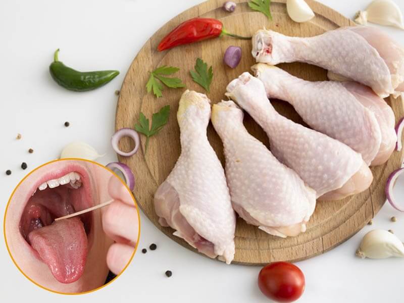 Những người bị viêm lợi có được ăn thịt gà không?