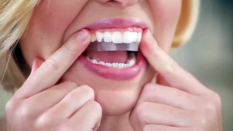 Cách sử dụng miếng dán trắng răng crest