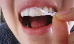 Cách sử dụng miếng dán trắng răng