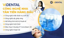 Trung Tâm Trồng Răng, Phục Hình Thẩm Mỹ Hàng Đầu Việt Nam - Viện Nha Khoa ViDental
