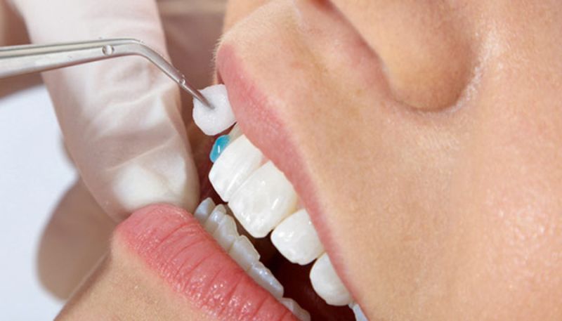 Bạn có thể lựa chọn sản phẩm phù hợp với nhu cầu và tình trạng răng