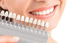 Quy trình trồng răng sứ sẽ có sự thay đổi tùy trường hợp cụ thể