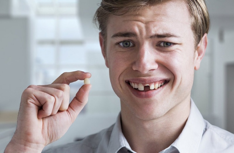 Người bị mất răng trên 18 tuổi nên cấy ghép implant