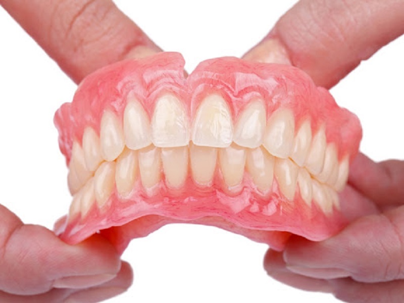 Phương pháp trồng răng tháo lắp