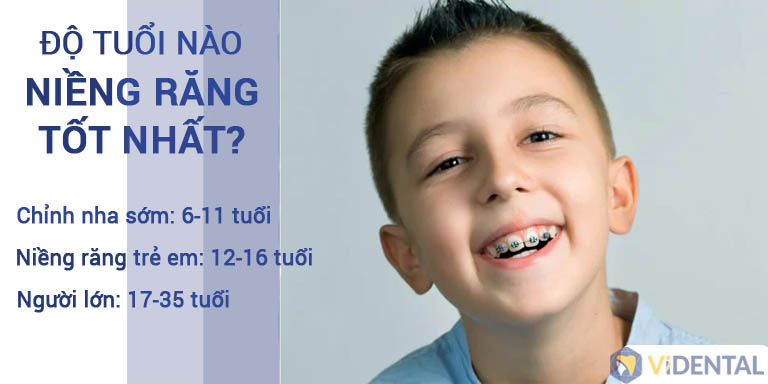 Thời điểm niềng răng đem lại hiệu quả tốt nhất cho trẻ