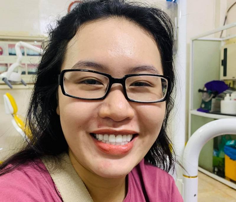 Nụ cười tỏa nắng của khách hàng sau khi thực hiện dịch vụ của nha khoa ở Bình Định
