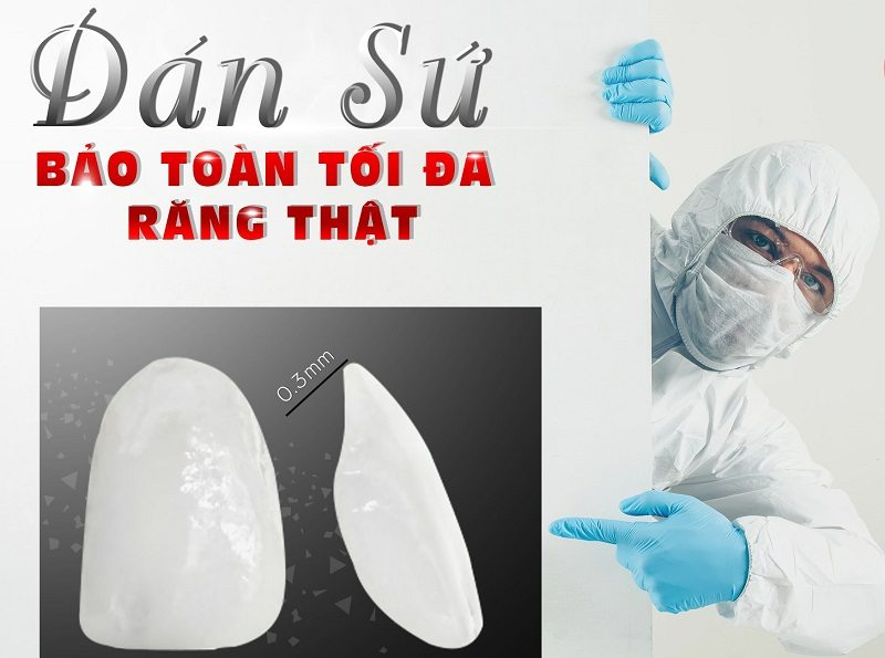 Dịch vụ dán răng sứ ở nha khoa Sài Gòn - Phan Thiết luôn mang đến sự hài lòng cho khách hàng 
