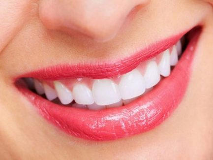 Răng cửa đều đẹp giúp bạn tự tin hơn khi giao tiếp