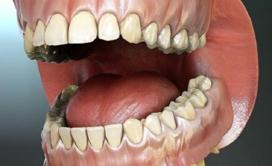 Răng giúp chúng ta thực hiện nhiều chức năng quan trọng, đặc biệt là ăn nhai