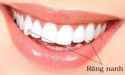 Răng nanh giúp cắn xé thức ăn dễ dàng hơn