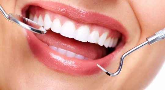 Nên khắc phục răng khấp khểnh bằng cách nào?