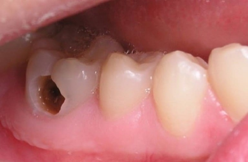 Điều trị các vấn đề về răng miệng là thế mạnh của Nha khoa Mỹ Hạnh Nam