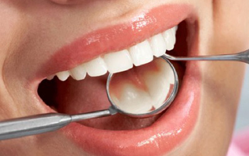Nên khám nha khoa thường xuyên để phát hiện sớm các bệnh lý răng miệng