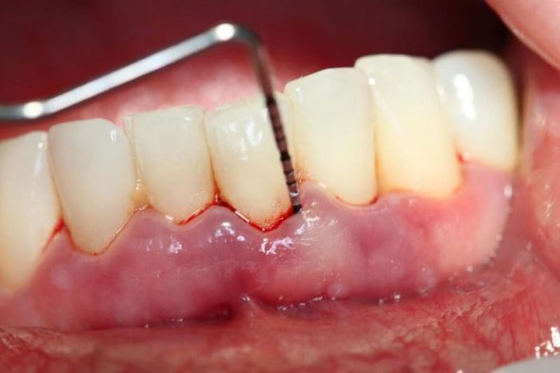 Nha khoa Hoàn Sinh chuyên điều trị các bệnh lý về răng miệng