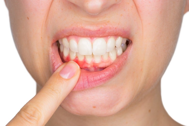 Nha khoa Sài Gòn ở Quảng Bình sẽ giúp bạn điều trị bệnh lý về răng miệng hiệu quả