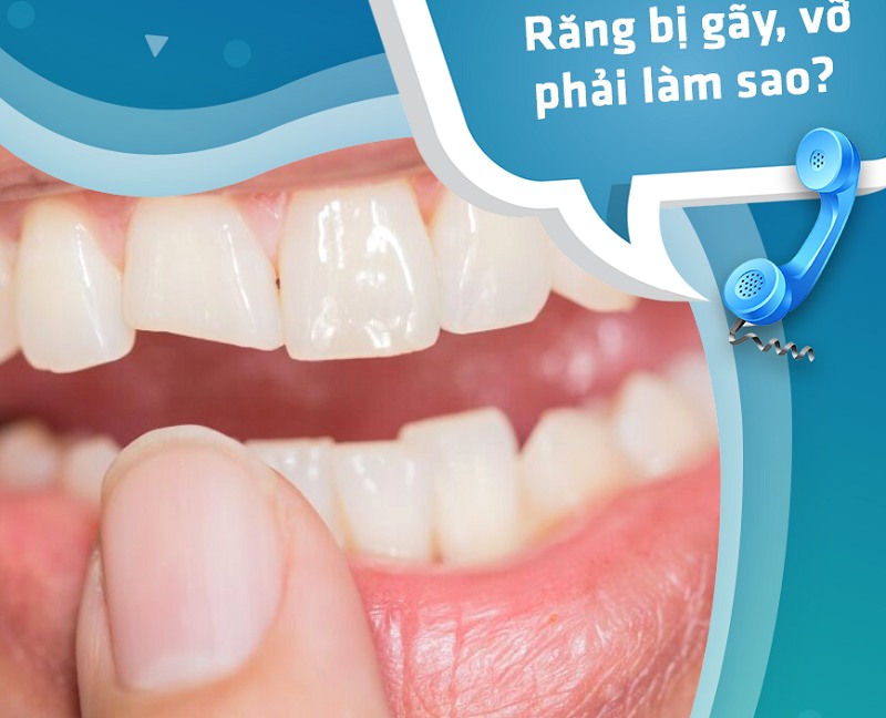 Gãy răng cùng không hề gì vì đã có nha khoa Việt Mỹ