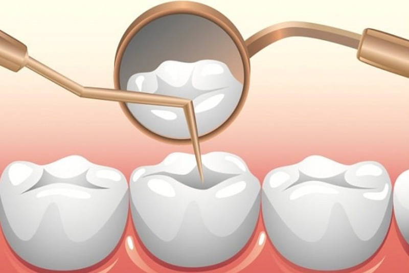 Chăm sóc sức khỏe răng miệng tốt hơn tại Nha khoa Sao Mai