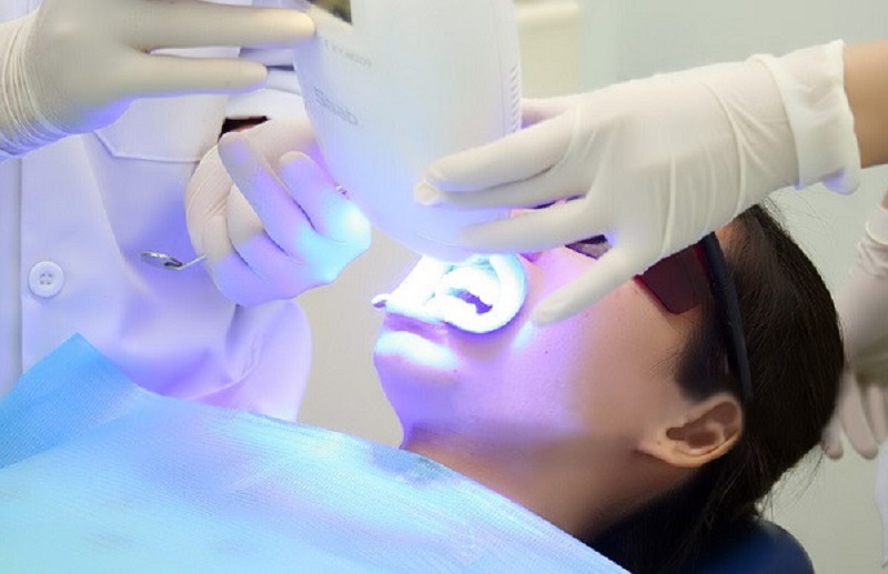 Tẩy trắng răng bằng Laser hiện đang là phương pháp hiện đại nhất hiện nay