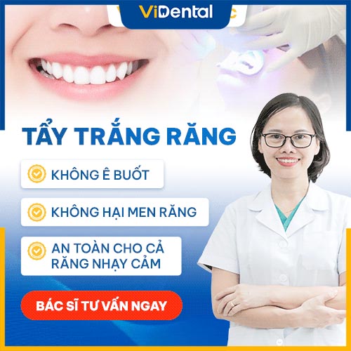 ViDental Clinic - Địa chỉ tẩy trắng răng uy tín tại TPHCM và trên toàn quốc