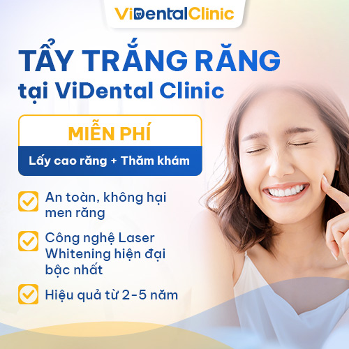 ViDental Clinic cung cấp dịch vụ tẩy trắng răng quận 7 TPHCM và toàn quốc