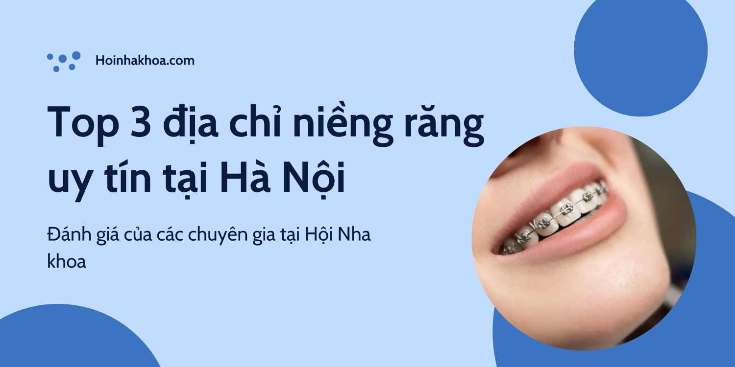 Top 3 địa chỉ niềng răng uy tín tại Hà Nội