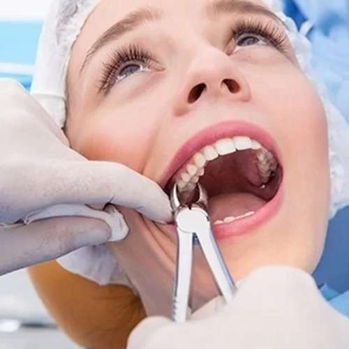 Tay nghề của bác sĩ ảnh hưởng đến vấn đề nhổ răng có đau không