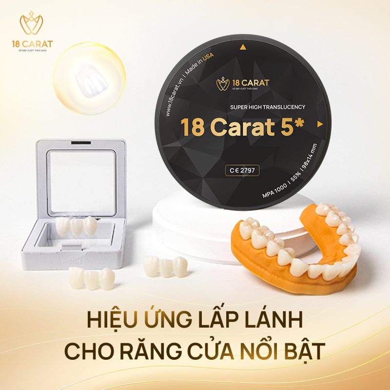 18 Carat mang đến hiệu ứng lấp lánh nổi bật